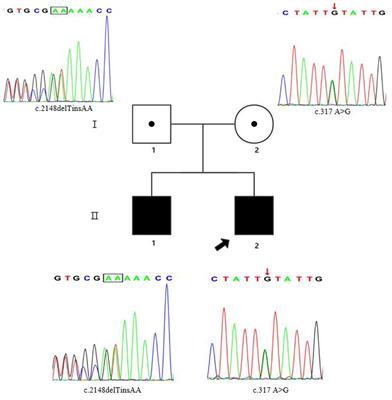 Case report and literature review: Novel compound heterozygous FIG4 variants causing both of peripheral and central nervous system defects